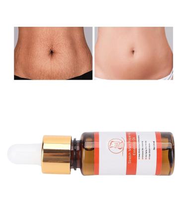 20ml Pregnancy Moisturizing & Repairing Stretch Marks Oil | Essential Care for Expecting Moms - Buy Online on GoSupps.com