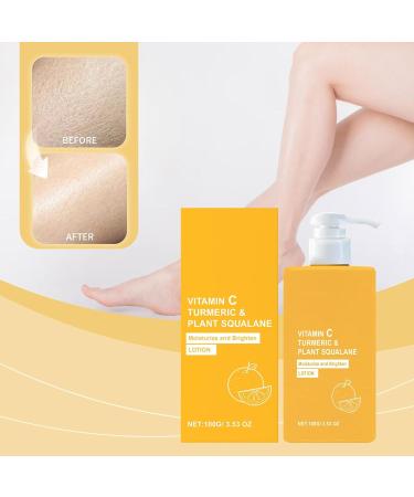  G n rique Turmeric and Vitamin C Cream Vitamin C Brightening Body Lotion Body Moisturizer Firming and Brightening Moisturizer Daily Skin Care - Buy Online on GoSupps.com