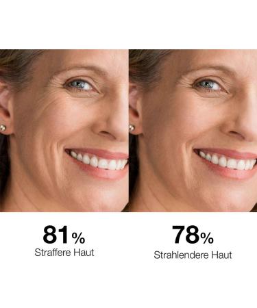 Bella Aurora Labs Bella Aurora Splendor Vitamin C + Hyaluronic Acid + Niacinamide Radiance and Antioxidant Serum AntiAging Serum in Ampoules AntiImperfections AntiWrinkles 30ml dropper - Buy Online on GoSupps.com