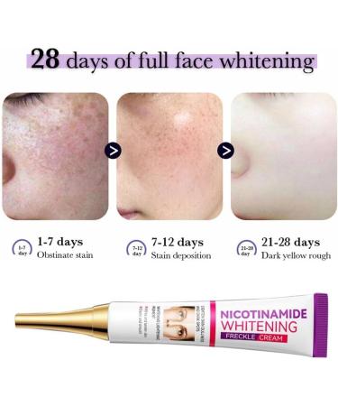 Cremas Para Las Manchas de La Cara Oscuras Para Eliminar Manchas en la Cara Crema Para Quitar Manchas de la Cara Crema Blanqueadora Para Pecas - Buy Online on GoSupps.com