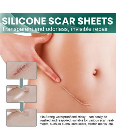 Fublazeze Scar Removal Paste - High Molecular Silicone Rubber for Trauma, Burn, and Skin Repair - Buy Online on GoSupps.com