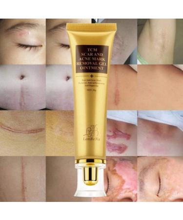 Symeas Scar & Acne Removal Cream - Effective Treatment for Stretch Marks Keloid Skin & Burns - 30g - Buy Online on GoSupps.com