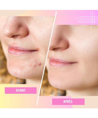  iDerm Paris 3-in-1 Night Depigmenting Cream - Anti-Spot Anti-Pigment Anti-Acne - Alpha Arbutin Niacinamide Vitamin C AHA/BHA - 50 ml - Buy Online on GoSupps.com