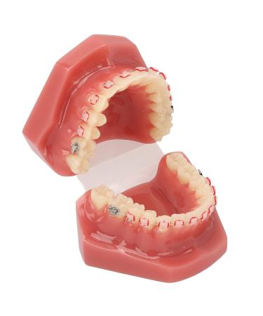 Orthodontic Demonstration Model for Dental Research | Metal Wires & Ceramic Brackets | Teaching Aids for Adults - Buy Internationally - Buy Online on GoSupps.com