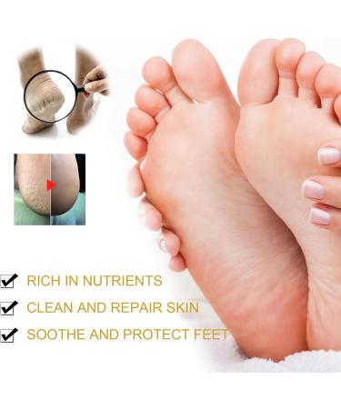 Cracked Heel Repair Foot Cream Cracking Cream Chapping Cream Winter Banana Anti-Cracking Frost Anti-Cracking Frost Feet Moisturizer Skin Repair Cream Anti-Drying Crack Cream - Buy Online on GoSupps.com