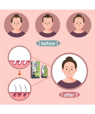 Anti-hair loss shampoo with ginger extract | Hair growth shampoo promotes hair growth | Ginger shampoo thick hair women and men - Buy Online on GoSupps.com