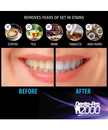 DentaPro2000 Professional Teeth Whitening Strips - Dentist Certified, Enamel Safe, Instant Results - 28 Ct - Buy Online on GoSupps.com