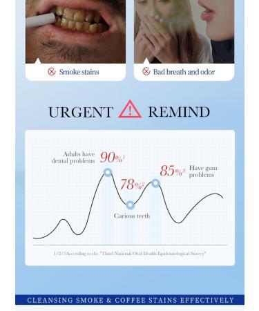 SP-7 Whitening Toothpaste (Red) - Clean Mouth & Anti-Caries | Buy Internationally - Buy Online on GoSupps.com