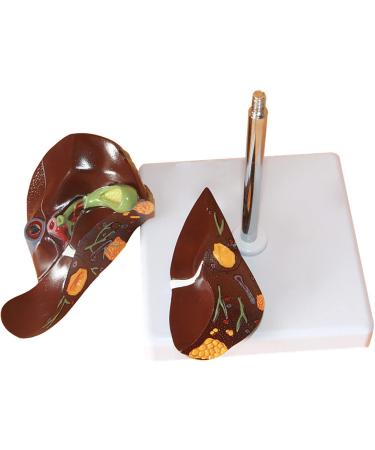 Life Size Human Liver Anatomical Model PVC Liver Pathology Model Disease Model for Human Body Mode for School - Buy Online on GoSupps.com