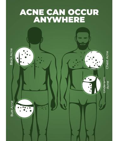 SODEN B-Acne Clear Body Wash 200ml - Neem Tea Tree & Salicylic Acid for Clear Skin - Buy Online Internationally - Buy Online on GoSupps.com