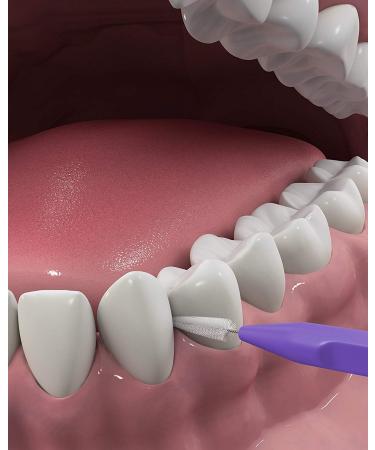 DenTek Slim Brush Interdental Cleansers - Extra Tight Mouthwash Blast | 32 ea | Best for Oral Hygiene - Buy Online on GoSupps.com