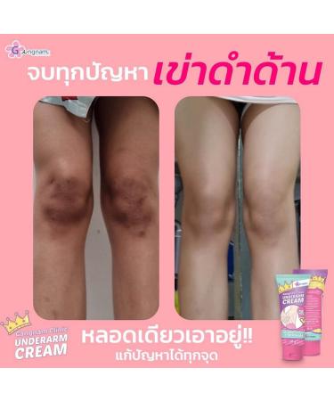 Gangnam Underarm Cream 30g - Light Texture Gentle Moisturizer | Buy 3 + Free Beauty Gifts at Beautygoodshop - Buy Online on GoSupps.com