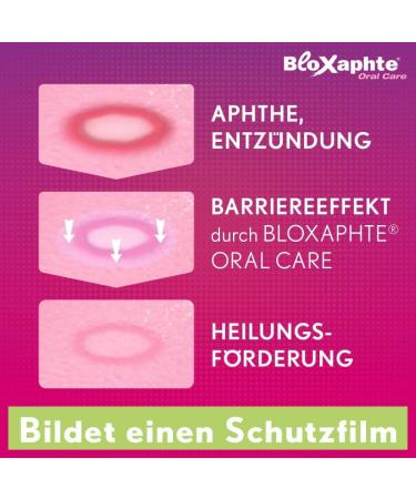 Bloxaphte Oral Care Spray 20 ml - Soothes Mouth Ulcers | Fast International Shipping - Buy Online on GoSupps.com