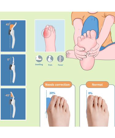 LOEFLIVG Adjustable Bunion Splint Toe Straightener - Pain Relief Corrector for Women & Men - Buy Online on GoSupps.com