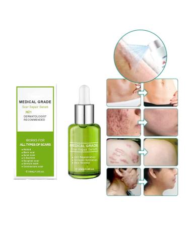 Proregen Medical Grade Scar Removal Spray - Advanced Formula for All Types of Scars (1pcs) - Buy Online on GoSupps.com