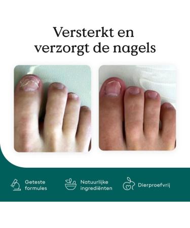 Brandize Health Routine Nail Care Pen 3piece set the original cosmetic care for fungal infections fast and effective for wellgroomed fingernails and toenails with tea tree oil vitamin E and 3 pack - Buy Online on GoSupps.com