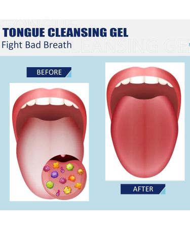 Tongue Cleaner Gel with Brush Set | Reduces Bad Breath & Enhances Oral Care | Easy Non-Synthetic Solution - Buy Online on GoSupps.com