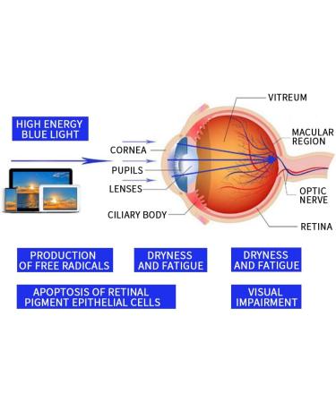 Suertree Blue Light Blocking Glasses - 95% Filter for Eye Protection - Unisex Computer & Reading Glasses (0.0x Diopter) - Black (1 Pack) - Buy Online on GoSupps.com