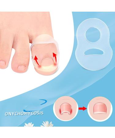 10PCS Silicone Ingrown Toenail Corrector Ingrown Toenail Corrector Set Nail Corrector Ring Silicone Ingrown Toenail Correcting Tool Washable Reusable Paronychia for Keep Nail He - Buy Online on GoSupps.com