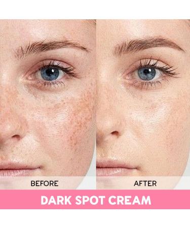 Dark Spot Corrector & Removal Cream - Oreola Naturals 100g for Face & Body | Brighten & Even Skin Tone - Buy Online on GoSupps.com