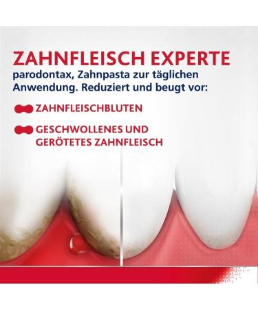 Parodontax Fluoride Toothpaste 75ml - Reduces Bleeding Gums International Shipping Available - Buy Online on GoSupps.com