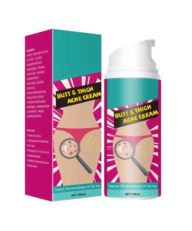 GNAUMORE Acne Cream for Buttocks Acne Cleansing Cream for Buttocks Cream for Buttock Spots Butt Acne Clearing Spot Treatment Spot Dissolving Cream for Buttocks 100ml