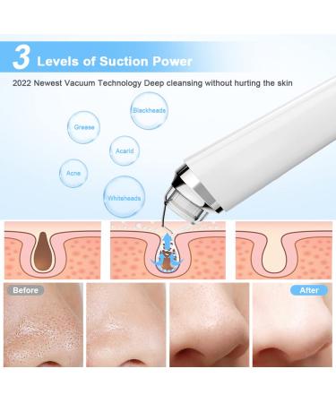 Silkwish Electric Blackhead Remover Pore Vacuum with HD Camera - USB Rechargeable Kit for Women & Men - Buy Online on GoSupps.com