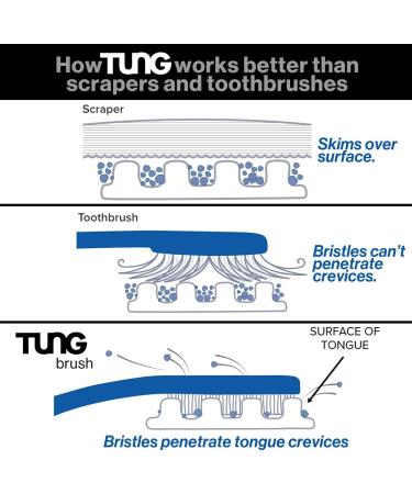 Peak Essentials Premium Tung Gel Tongue Cleaner | Fight Bad Breath & Odor | Fresh Mint | BPA Free | Made in USA | 2 Count 3 Ounce Pack - Buy Online on GoSupps.com