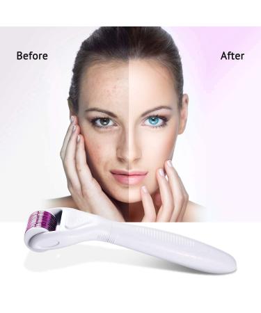 6 in 1 Derma Roller Kit for Face and Body - Micro Needle Dermaroller with Replaceable Heads, Storage Case, and Disinfection Tank - Buy Online on GoSupps.com