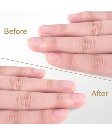 Easkep Cuticle Trimmer and Pusher Set - Stainless Steel Professional Cuticle Remover for Fingernails and Toenails - Buy Online on GoSupps.com