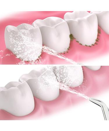 Portable Orthodontic Tooth Dispenser | Universal 3 Pack | Unisex Periodontal Tip - Professional Quality - Buy Online on GoSupps.com