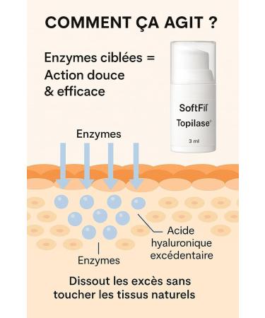  softfil cosmectics SoftFil Topilase - Post-Act Dermo-Adjuster - Corrects Excess Fillers & Imperfections - Soothing Effect - 100% Natural - Rebalances the Skin - Safe Application Without Injection - 2 ml Bottle - Buy Online on GoSupps.com