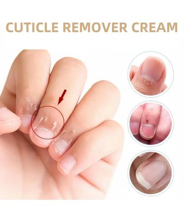 Cuticle Remover Cream Nail Cuticle Remover Gel Cuticle Oil for Nails Cuticle Care Gel Cuticle Remover Liquid Nail Treatments Cuticle Softener and Remover Nail Oil Cuticle Pen Instant Cuticle Remover - Buy Online on GoSupps.com