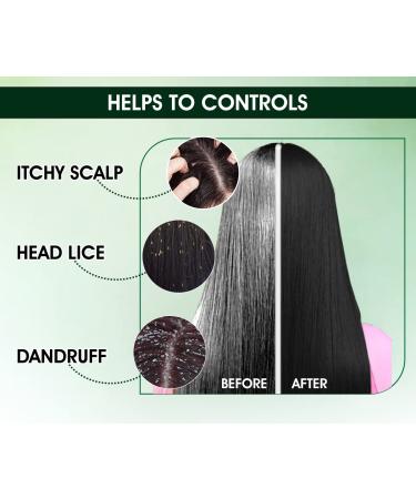 Urban Yog Ayurvedic Kalonji Onion Black Seed Oil for Hair, Face & Skin Care | 7 Fl Oz - Promotes Growth for Dry and Damaged Hair - Buy Online on GoSupps.com