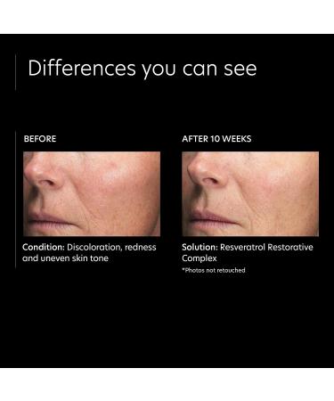 PCA SKIN Resveratrol Restorative Anti Aging Face Serum (1 fl oz) - Buy Online on GoSupps.com