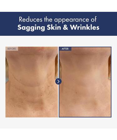 Intense Lifting Neck Cream - Firming & Tightening with Hyaluronic Acid Collagen & Shea Butter - 50g Advanced Skin Care - Buy Online on GoSupps.com