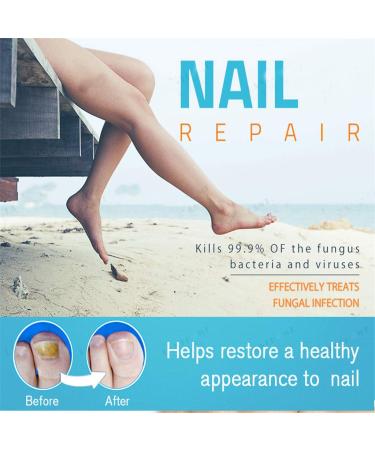 Nail Regeneration Bio-Pen 2Pcs Set for Effective Fragile Nail Repair - Men Women (Blue) - Buy Online on GoSupps.com