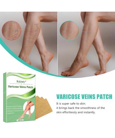 Varicose Veins Patch - Effective Treatment for Spider Veins | 12 Pcs | Fast International Shipping - Buy Online on GoSupps.com