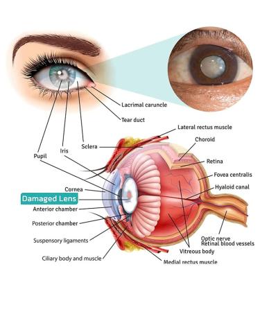 OphthlaMed Vision Enhance Roller - Relieve Eye Strain, Enhance Visual Clarity - 1PCS/8mm (4pcs) - Buy Online on GoSupps.com