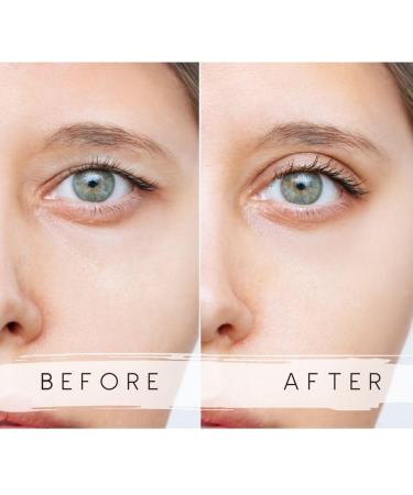 Buy M+L+XL Eyelid Tape Strips | Instant Eyelid Lift for Hooded & Droopy Eyes | Waterproof 24h Stay | International Shipping Available - Buy Online on GoSupps.com