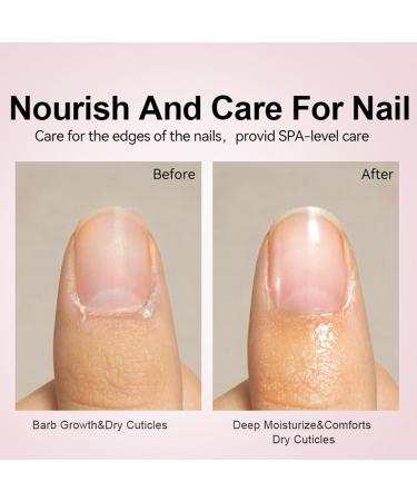 Natural Cuticle Oil: Nourishing Nail Growth Stimulator 15ml Conditioner to Strengthen Cracked Nails | Avocado Oil Cuticle Repair - Buy Online on GoSupps.com