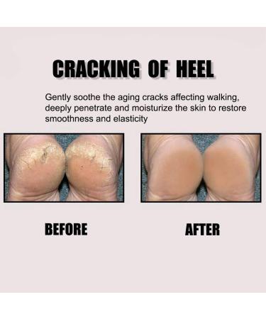 Brillistar Silicone Gel Socks - 2 Pair Heel & Ankle Sleeve for Plantar Fasciitis Relief | Comfortable Foot Pain Relief for Men & Women - Buy Online on GoSupps.com