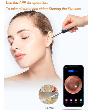 Wireless Ear Wax Removal Endoscope | 1080P FHD Camera | 6 LED Lights | iPhone, iPad, Android | Safely Remove Earwax - Buy Online on GoSupps.com
