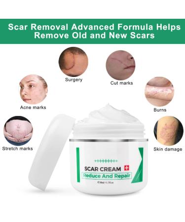 Scar Cream for Surgical & Acne Scars | Effective Scar Treatment Gel - 1.7 Fl. Oz - Reduce & Remove Old & New Scars - Buy Online on GoSupps.com
