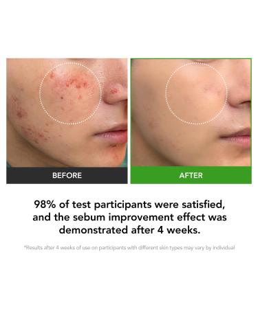 KIOSKIN 31% Reduction in Sebum & 15.5% High-Dose D-Panthenol Calms Redness Repairs Skin Barrier & Locks in Hydration With Heartleaf Extract & Hyaluronic Acid Korean Skincare Top Barrier Cream - Buy Online on GoSupps.com