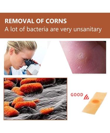 Wart Remover Pads - Treatment for Hands and Feet, Callus Removal, Verruca Relief, Pain Removal - 20 Count Pack - Buy Online on GoSupps.com