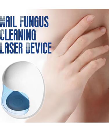 YOXIER Convenient Nail Care Device Non-invasive Fungus Treatment Cleansing Lasers Relief Easy to Operate Blue Light Therapy Infrared White - Buy Online on GoSupps.com