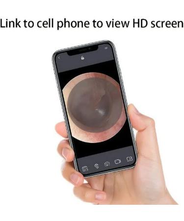 Home Ear Wax Removal Kit with 1080P Camera - Ear Cleaner with LED Light for iPhone & Android - Buy Online on GoSupps.com