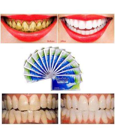 Henylas Tooth Whitening Stripes - Pain-Free Home Bleaching Kit | 14 Professional Strips for Brightening Teeth - Buy Online on GoSupps.com