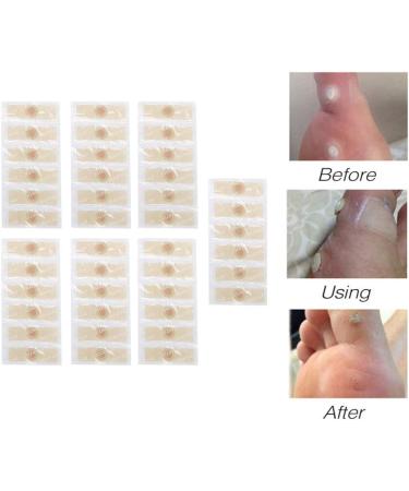 7Pcs Foot Corn Removal Plaster for Calluses | Foot Health Care Relief - Buy Online on GoSupps.com